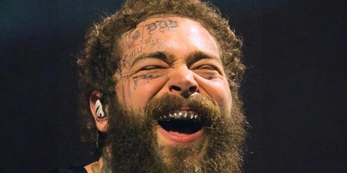 Grill master: Everything to know about Post Malone’s new teeth